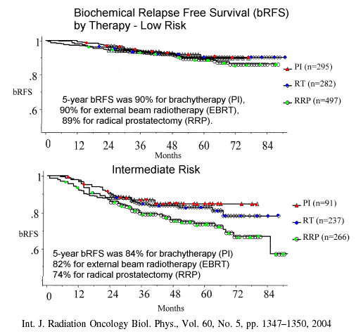 Prostate Cancer External Beam Radiation Vs Brachytherapy